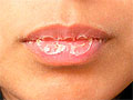 От чего бывают пересохшие губы?