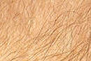 Ученые вырастили кожу с волосами