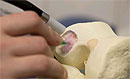 В Австралии разработали хирургический 3D-принтер, создающий человеческие ткани